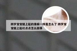 四岁宝宝腿上起的像癣一样是怎么了 四岁宝宝腿上起红点点怎么回事