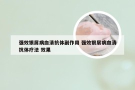 强效银屑病血清抗体副作用 强效银屑病血清抗体疗法 效果