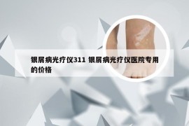 银屑病光疗仪311 银屑病光疗仪医院专用的价格