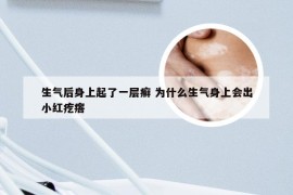 生气后身上起了一层癣 为什么生气身上会出小红疙瘩