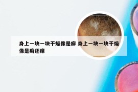 身上一块一块干燥像是癣 身上一块一块干燥像是癣还痒