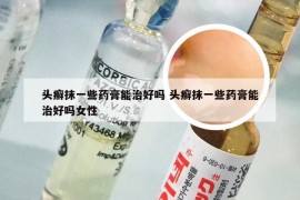 头癣抹一些药膏能治好吗 头癣抹一些药膏能治好吗女性