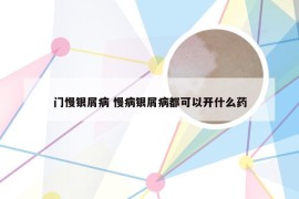 门慢银屑病 慢病银屑病都可以开什么药