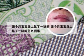 四个月宝宝身上起了一块癣 四个月宝宝身上起了一块癣怎么回事