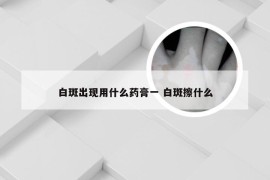 白斑出现用什么药膏一 白斑擦什么