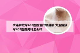 大连解放军403医院治疗银屑病 大连解放军403医院男科怎么样