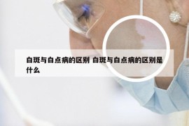 白斑与白点病的区别 白斑与白点病的区别是什么