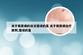 关于银屑病的说法错误的是 关于银屑病治疗原则,错误的是