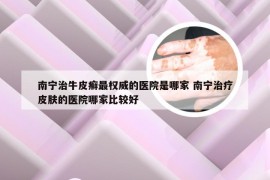 南宁治牛皮癣最权威的医院是哪家 南宁治疗皮肤的医院哪家比较好