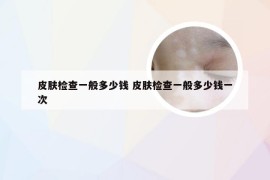 皮肤检查一般多少钱 皮肤检查一般多少钱一次