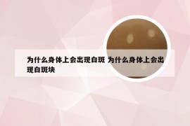 为什么身体上会出现白斑 为什么身体上会出现白斑块