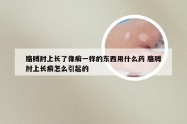 胳膊肘上长了像癣一样的东西用什么药 胳膊肘上长癣怎么引起的