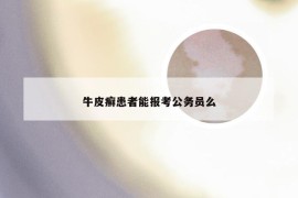 牛皮癣患者能报考公务员么