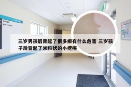 三岁男孩后背起了很多癣有什么危害 三岁孩子后背起了米粒状的小疙瘩