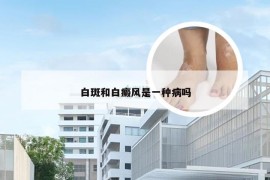 白斑和白癜风是一种病吗