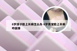 6岁孩子脸上长癣怎么办 6岁男宝脸上长癣咋回事