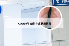 COQ10牛皮癣 牛皮肤癣新药