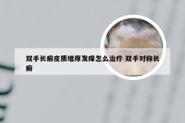 双手长癣皮质增厚发痒怎么治疗 双手对称长癣