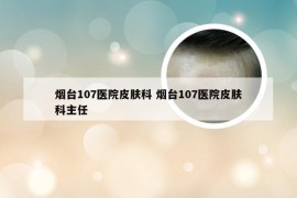 烟台107医院皮肤科 烟台107医院皮肤科主任