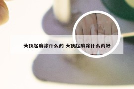 头顶起癣涂什么药 头顶起癣涂什么药好