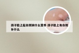 孩子脸上起白斑缺什么营养 孩子脸上有白斑补什么