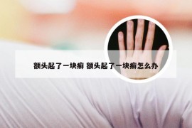 额头起了一块癣 额头起了一块癣怎么办