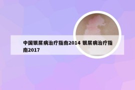 中国银屑病治疗指南2014 银屑病治疗指南2017