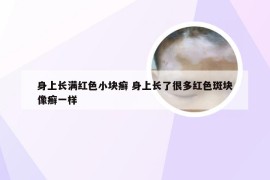 身上长满红色小块癣 身上长了很多红色斑块像癣一样