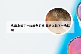 乳房上长了一块红色的癣 乳房上长了一块红斑