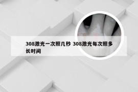 308激光一次照几秒 308激光每次照多长时间