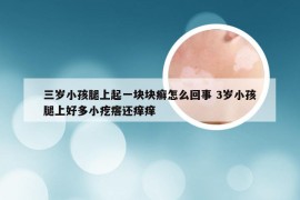 三岁小孩腿上起一块块癣怎么回事 3岁小孩腿上好多小疙瘩还痒痒