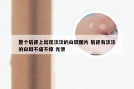 整个后背上出现淡淡的白斑图片 后背有淡淡的白斑不痛不痒 光滑