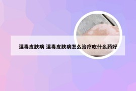 湿毒皮肤病 湿毒皮肤病怎么治疗吃什么药好