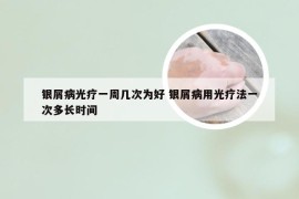 银屑病光疗一周几次为好 银屑病用光疗法一次多长时间