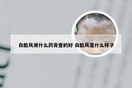 白脸风用什么药膏查的好 白脸风是什么样子