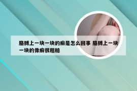 胳膊上一块一块的癣是怎么回事 胳膊上一块一块的像癣很粗糙