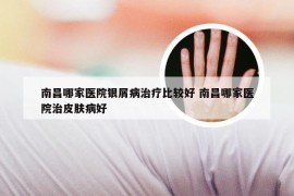 南昌哪家医院银屑病治疗比较好 南昌哪家医院治皮肤病好