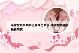 寻常型银屑病的进展期怎么治 寻常型银屑病最新研究