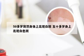 50多岁突然身体上出现白斑 五十多岁身上出现白色斑