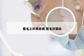 眉毛上长银屑病 眉毛长银丝