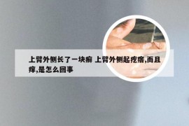 上臂外侧长了一块癣 上臂外侧起疙瘩,而且痒,是怎么回事