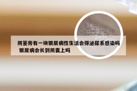 阴茎旁有一块银屑病性生活会得泌尿系感染吗 银屑病会长到阴囊上吗