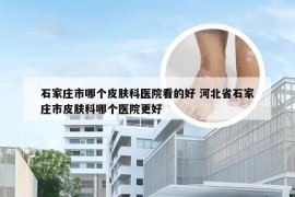 石家庄市哪个皮肤科医院看的好 河北省石家庄市皮肤科哪个医院更好