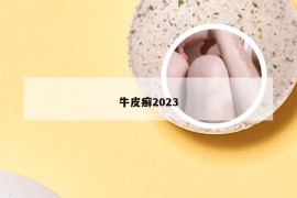 牛皮癣2023