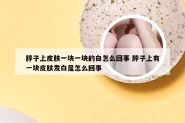 脖子上皮肤一块一块的白怎么回事 脖子上有一块皮肤发白是怎么回事