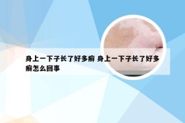 身上一下子长了好多癣 身上一下子长了好多癣怎么回事