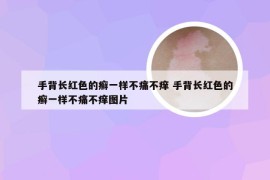 手背长红色的癣一样不痛不痒 手背长红色的癣一样不痛不痒图片