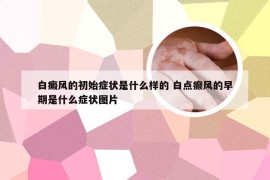 白癜风的初始症状是什么样的 白点癫风的早期是什么症状图片