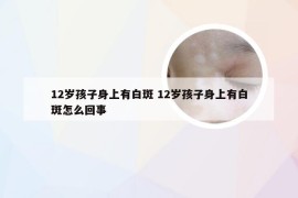 12岁孩子身上有白斑 12岁孩子身上有白斑怎么回事