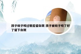 孩子蚊子咬过敏后留白斑 孩子被蚊子咬了好了留下白斑